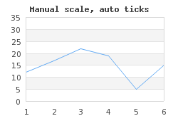 Setting tick density to TICKD_DENSE (manscaleex3.php)